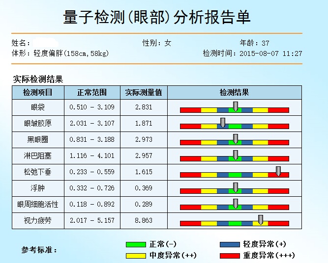眼部量子亞健康檢測項目